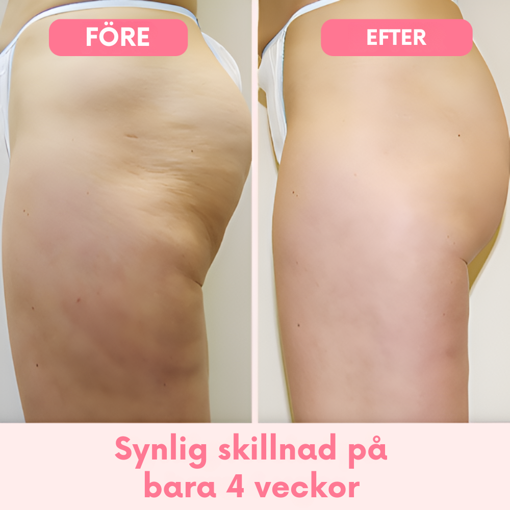 CelluEase™ – Slank och slät, helt naturligt