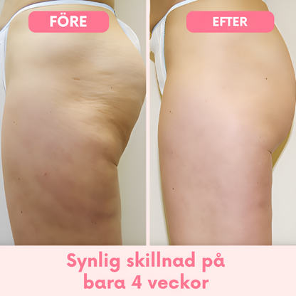 CelluEase™ – Slank och slät, helt naturligt